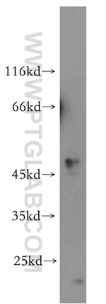 STYK1 Antibody in Western Blot (WB)