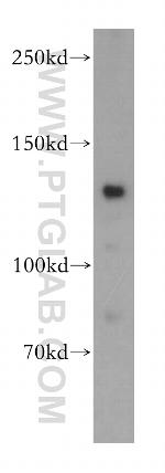CARD6 Antibody in Western Blot (WB)