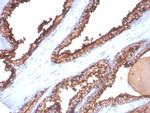 CD26 (DPP IV/ADA-Binding Protein) Monoclonal Antibody (DPP4/7415)
