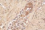 TNKS Antibody in Immunohistochemistry (Paraffin) (IHC (P))