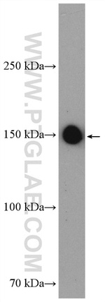 TNKS Antibody in Western Blot (WB)