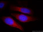 TNKS Antibody in Immunocytochemistry (ICC/IF)