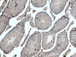 TNKS Antibody in Immunohistochemistry (Paraffin) (IHC (P))