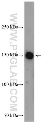 TNKS Antibody in Western Blot (WB)