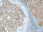 CGNL1 Antibody in Immunohistochemistry (Paraffin) (IHC (P))