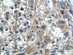 CGNL1 Antibody in Immunohistochemistry (Paraffin) (IHC (P))