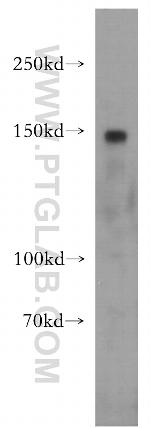 CGNL1 Antibody in Western Blot (WB)