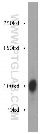 SAP102 Antibody in Western Blot (WB)