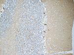 CHRNB3 Antibody in Immunohistochemistry (Paraffin) (IHC (P))