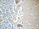 CHRNB3 Antibody in Immunohistochemistry (Paraffin) (IHC (P))