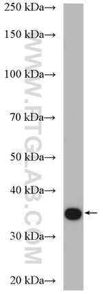 CCNY Antibody in Western Blot (WB)