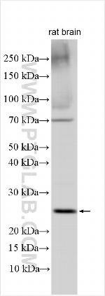 PGLYRP1 Antibody in Western Blot (WB)