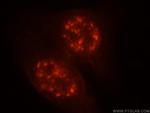 MLN51/CASC3 Antibody in Immunocytochemistry (ICC/IF)