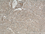 MLN51/CASC3 Antibody in Immunohistochemistry (Paraffin) (IHC (P))