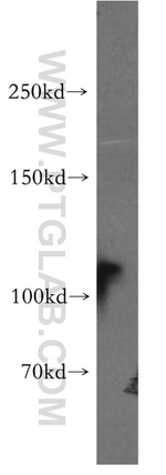 MLN51/CASC3 Antibody in Western Blot (WB)