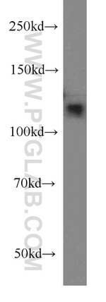 MLN51/CASC3 Antibody in Western Blot (WB)