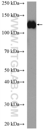 MLN51/CASC3 Antibody in Western Blot (WB)