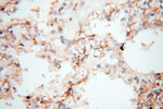 PTPN14 Antibody in Immunohistochemistry (Paraffin) (IHC (P))