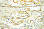 PTPN14 Antibody in Immunohistochemistry (Paraffin) (IHC (P))
