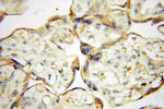 PTPN14 Antibody in Immunohistochemistry (Paraffin) (IHC (P))