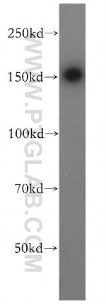 PTPN14 Antibody in Western Blot (WB)