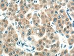 CYP7A1 Antibody in Immunohistochemistry (Paraffin) (IHC (P))