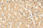 CYP7A1 Antibody in Immunohistochemistry (Paraffin) (IHC (P))