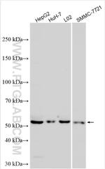 CYP7A1 Antibody in Western Blot (WB)
