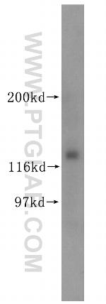 KIRREL3 Antibody in Western Blot (WB)