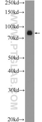 USP49 Antibody in Western Blot (WB)