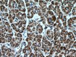 PDH E1 alpha Antibody in Immunohistochemistry (Paraffin) (IHC (P))