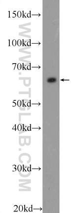 FKBP9 Antibody in Western Blot (WB)