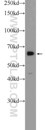 FKBP9 Antibody in Western Blot (WB)