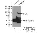 PCDHA9 Antibody in Immunoprecipitation (IP)