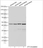 SLC17A2 Antibody in Western Blot (WB)