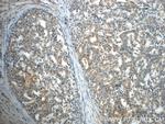 MMP26 Antibody in Immunohistochemistry (Paraffin) (IHC (P))