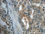 MMP26 Antibody in Immunohistochemistry (Paraffin) (IHC (P))