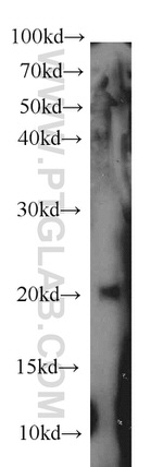 MMP26 Antibody in Western Blot (WB)