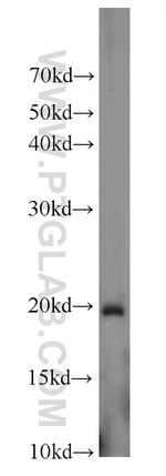 MMP26 Antibody in Western Blot (WB)