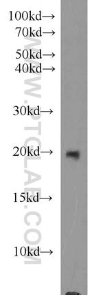 MMP26 Antibody in Western Blot (WB)