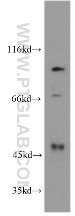 PLA2G4E Antibody in Western Blot (WB)