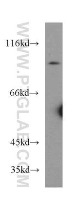 PLA2G4E Antibody in Western Blot (WB)