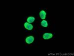 HIST1H1B Antibody in Immunocytochemistry (ICC/IF)