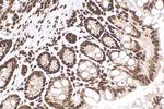 HIST1H1B Antibody in Immunohistochemistry (Paraffin) (IHC (P))