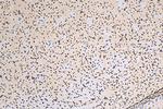 HIST1H1B Antibody in Immunohistochemistry (Paraffin) (IHC (P))