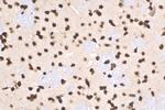 HIST1H1B Antibody in Immunohistochemistry (Paraffin) (IHC (P))
