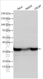 HIST1H1B Antibody in Western Blot (WB)