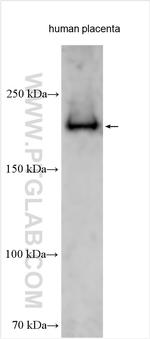PAPPA Antibody in Western Blot (WB)