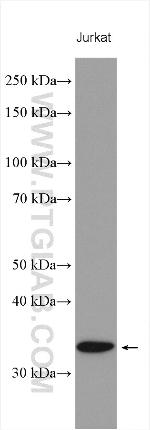 CENPP Antibody in Western Blot (WB)