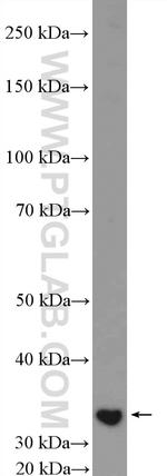 CENPP Antibody in Western Blot (WB)
